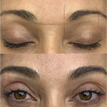 antes e depois7