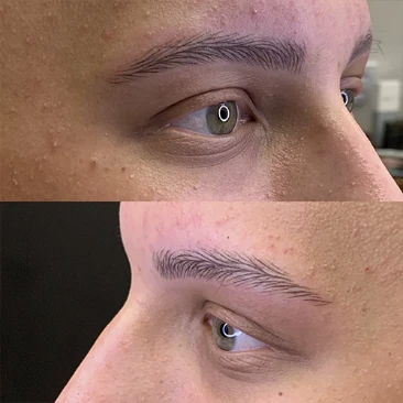 antes e depois2.avif