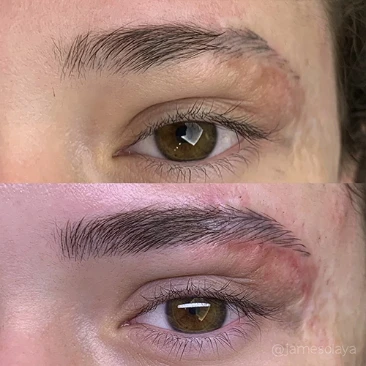 antes e depois5.avif