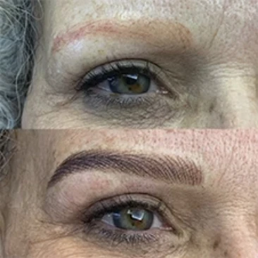 antes e depois1